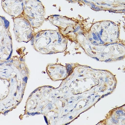 Anti-CD39 antibody used in IHC (Paraffin sections) (IHC-P). GTX57161