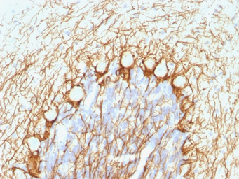 Anti-NF-H (phospho) antibody [NE14] used in IHC (Paraffin sections) (IHC-P). GTX57165