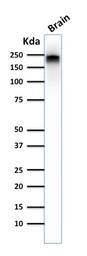 Anti-NF-H (phospho) antibody [NE14] used in Western Blot (WB). GTX57165