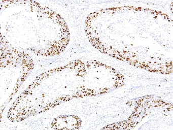 Anti-Ki67 antibody [IHC067] used in IHC (Paraffin sections) (IHC-P). GTX57186