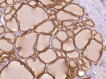 Anti-PAX8 antibody [IHC008] used in IHC (Paraffin sections) (IHC-P). GTX57191