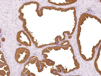Anti-Prostatic Acid Phosphatase antibody [IHC655] used in IHC (Paraffin sections) (IHC-P). GTX57196