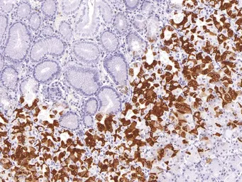 Anti-Mucin 6 antibody [IHC626] used in IHC (Paraffin sections) (IHC-P). GTX57206