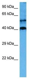Anti-SOX18 antibody used in Western Blot (WB). GTX57216