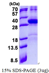 Human Hes7 protein, His tag. GTX57241-pro