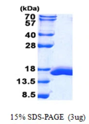 Mouse Galectin 2 protein, His tag. GTX57286-pro