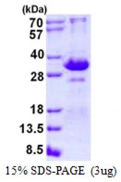 Human TIRAP protein, His tag. GTX57295-pro