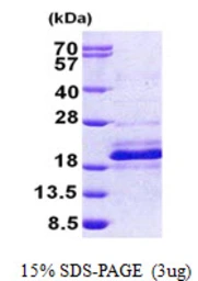 Human DPH4 protein, His tag. GTX57310-pro