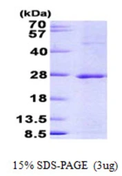 Human JDP2 protein, His tag. GTX57314-pro