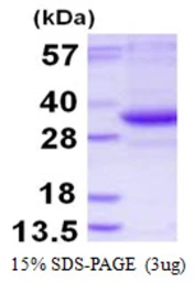 Human TATDN3 protein, His tag. GTX57326-pro