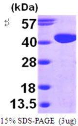 Human GALM protein, His tag. GTX57330-pro