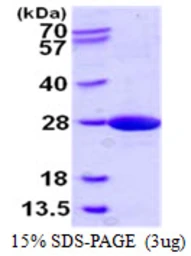 Human NCE2 protein, His tag. GTX57349-pro