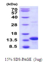 Human BOLA3 protein, His tag. GTX57424-pro