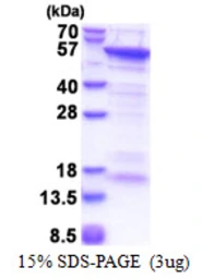 Human CUEDC1 protein, His tag. GTX57433-pro