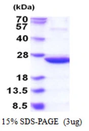E. coli idnk protein, His tag. GTX57468-pro