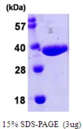 E. coli nanA protein, His tag. GTX57487-pro