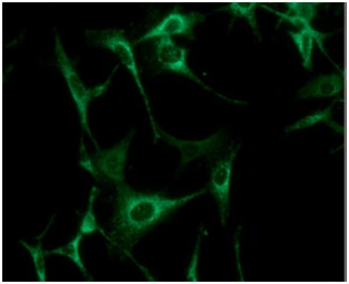 Anti-AK3 antibody [SJB3-36] used in Immunocytochemistry/ Immunofluorescence (ICC/IF). GTX57541