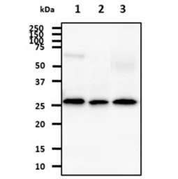 Anti-AK3 antibody [SJB3-36] used in Western Blot (WB). GTX57541