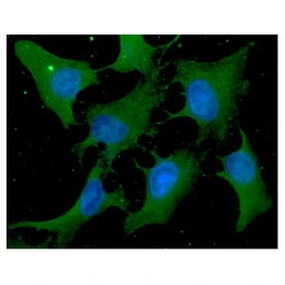 Anti-Cofilin 1 antibody [AT1C1] used in Immunocytochemistry/ Immunofluorescence (ICC/IF). GTX57545