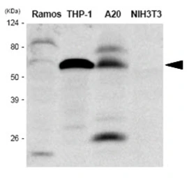 Anti-IRF5 antibody [10T1] used in Western Blot (WB). GTX57552