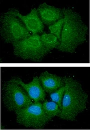 Anti-IL6 antibody [AT1H6] used in Immunocytochemistry/ Immunofluorescence (ICC/IF). GTX57562