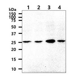 Anti-OSTF1 antibody [AT9G4] used in Western Blot (WB). GTX57564