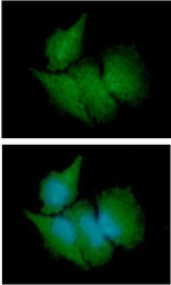 Anti-CBR3 antibody [AT7E8] used in Immunocytochemistry/ Immunofluorescence (ICC/IF). GTX57565