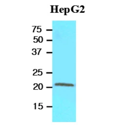 Anti-RBP4 antibody [AT2B4] used in Western Blot (WB). GTX57569