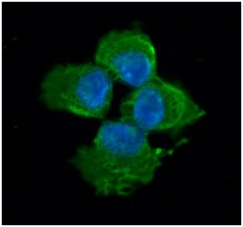 Anti-Myosin Light Chain 2 (MLC-2v) antibody [AT3B2] used in Immunocytochemistry/ Immunofluorescence (ICC/IF). GTX57570