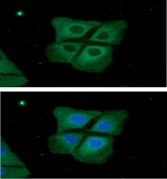 Anti-Pyruvate Kinase (liver/RBC) antibody [AT1E3] used in Immunocytochemistry/ Immunofluorescence (ICC/IF). GTX57581