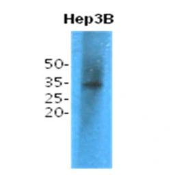 Anti-TPMT antibody [AT2E7] used in Western Blot (WB). GTX57582