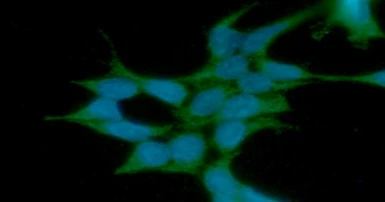 Anti-HIP antibody [AT5C6] used in Immunocytochemistry/ Immunofluorescence (ICC/IF). GTX57598