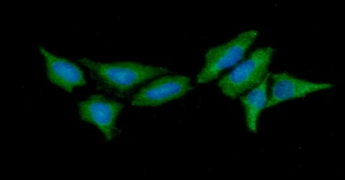Anti-HIP antibody [AT5C6] used in Immunocytochemistry/ Immunofluorescence (ICC/IF). GTX57598
