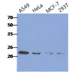 Anti-RAIDD antibody [AT14G8] used in Western Blot (WB). GTX57605