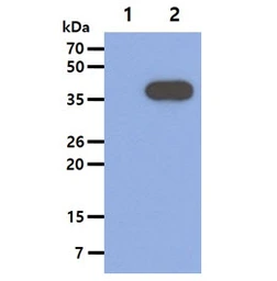 Anti-ACAT2 antibody [AT55D5] used in Western Blot (WB). GTX57610