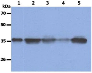 Anti-Nucleophosmin antibody [AT23F1] used in Western Blot (WB). GTX57613