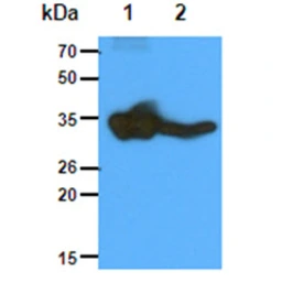 Anti-GNMT antibody [AT5D1] used in Western Blot (WB). GTX57629