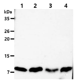 Anti-DYNLL1 antibody [AT13C9] used in Western Blot (WB). GTX57639
