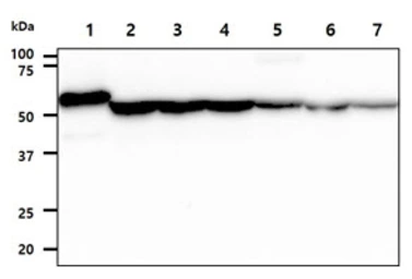 Anti-ADSL antibody [AT16C10] used in Western Blot (WB). GTX57653
