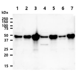 Anti-NDRG1 antibody [AT11G4] used in Western Blot (WB). GTX57654