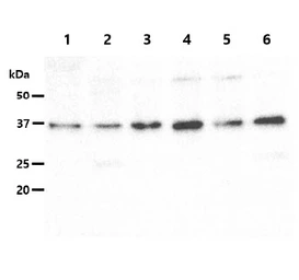Anti-GALE antibody [AT6G10] used in Western Blot (WB). GTX57657