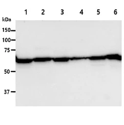 Anti-PGM1 antibody [AT84G2] used in Western Blot (WB). GTX57659