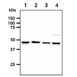 Anti-SHMT1 antibody [AT26E5] used in Western Blot (WB). GTX57666