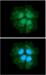 Anti-DECR1 antibody [AT3B2] used in Immunocytochemistry/ Immunofluorescence (ICC/IF). GTX57680