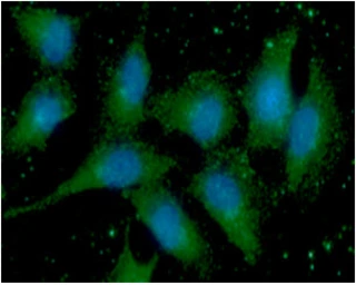 Anti-S100A11 antibody [AT20D11] used in Immunocytochemistry/ Immunofluorescence (ICC/IF). GTX57683