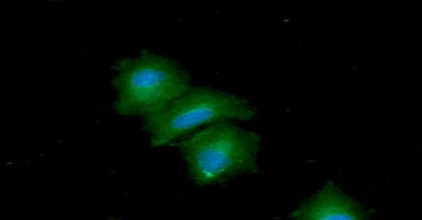 Anti-TIP30 antibody [AT5D6] used in Immunocytochemistry/ Immunofluorescence (ICC/IF). GTX57690