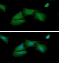 Anti-Adenylate kinase 1 antibody [AT7E9] used in Immunocytochemistry/ Immunofluorescence (ICC/IF). GTX57693