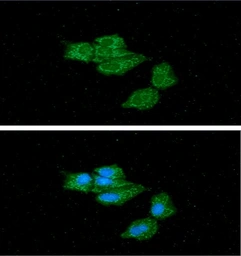 Anti-ACADS antibody [AT8B10] used in Immunocytochemistry/ Immunofluorescence (ICC/IF). GTX57702
