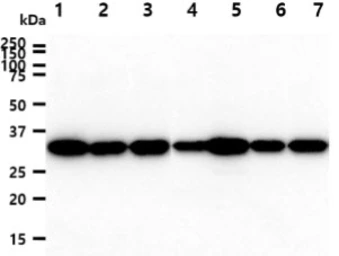 Anti-Cyclophilin E antibody [AT17E8] used in Western Blot (WB). GTX57706