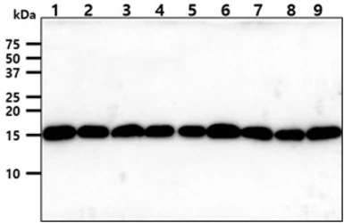 Anti-TOMM20 antibody [AT1B2] used in Western Blot (WB). GTX57716